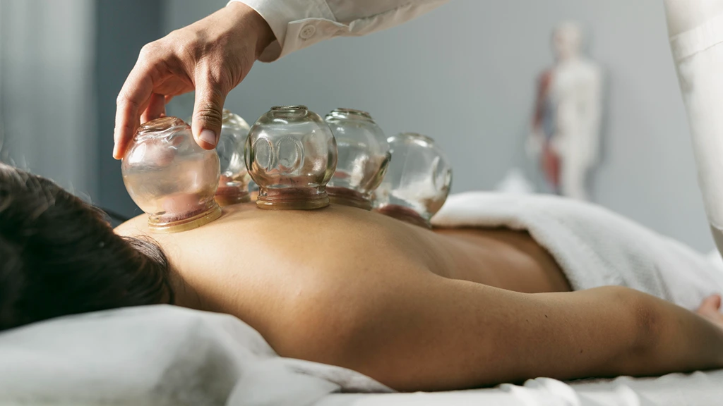 Most Popular Alternative Medicine in Indonesia Cupping