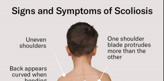 Scoliosis in Children